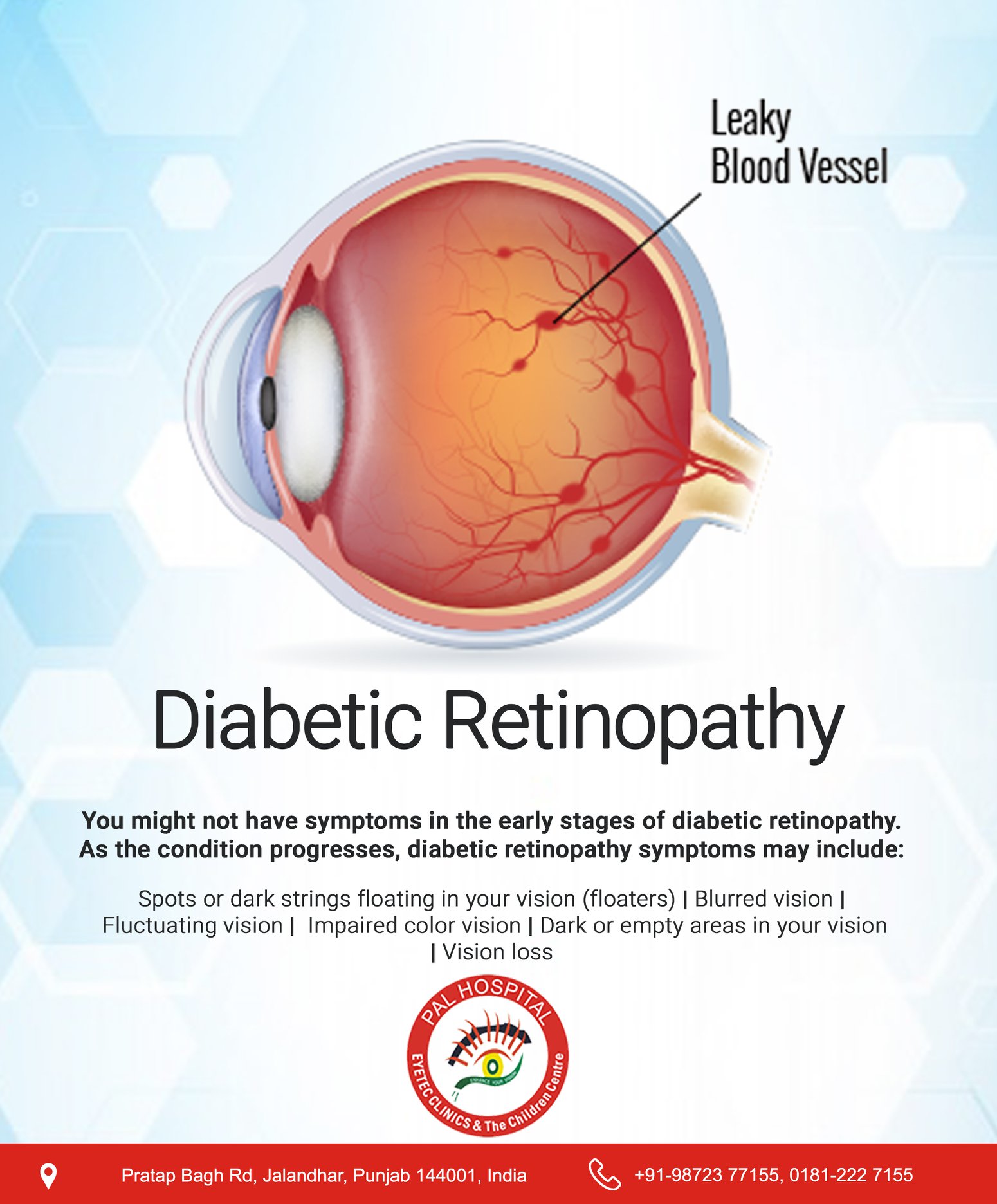 Diabetic Retinopathy Treatment In Jalandhar - Pal Hospital Eyetec Clinics & The Children Centre
